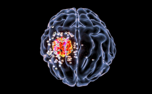 Mutațiile genetice din tumorile cerebrale canceroase, depistate cu ajutorul IA