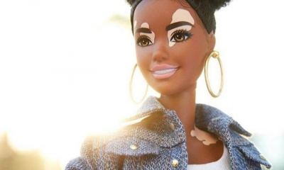 Barbie lanseaza o papusa cu boala Vitiligo
