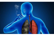 Ghid online pentru pacienții cu cancer pulmonar