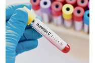 Ieșenii se pot testa gratuit pentru virusul hepatic