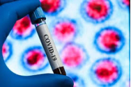 BREAKING - Teste puține, cazuri mai puține de coronavirus: 755 de cazuri noi și 183 retestați pozitiv