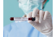  Test rapid petru coronavirus. Afli rezultatul în doar 15 minute