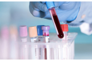 Un test de sânge poate să prezică șansele de supraviețuire ale unui bolnav de Covid-19