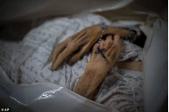 Declarată moartă de COVID, o femeie de 85 de ani a revenit la familia ei