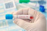 Cum poți afla dacă ai sau nu imunitate împotriva COVID - totul despre testarea imunologică anticorpi ANTI-2019-nCOV IgM/IgG