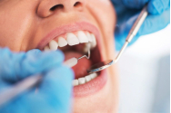 Doi falși dentiști au fost prinși într-un cabinet neautorizat din București