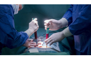  Pacienții români vor putea face anual 5 operații de transplant pulmonar în 10 centre din Italia
