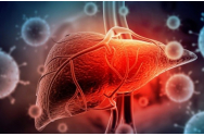  Ce este și cum se manifestă hepatita cronică virală D?