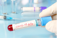  97% din decesele COVID de săptămâna trecută au fost la persoane nevaccinate. Suceava, lider la infectări în Moldova