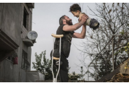 Italia, emoționată de fotografia unui tată ce își ține în brațe copilul născut fără mâini și fără picioare