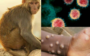 Prima țară care impune carantină obligatorie pentru persoanele infectate cu variola maimuței