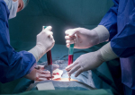 Medicii ieșeni au efectuat o prelevare de rinichi la un spital din Chişinău