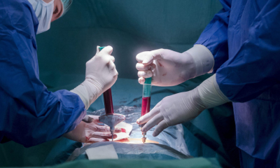 Medicii ieșeni au efectuat o prelevare de rinichi la un spital din Chişinău