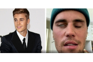 Cântărețul Justin Bieber suferă de paralizie facială