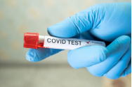 Bilanț COVID - 1000 de cazuri noi în ultimele 24 de ore