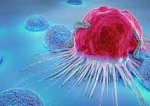 Cancerul, vindecat prin imunoterapie și inteligență artificială