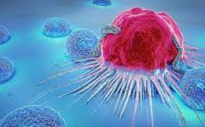 Cancerul, vindecat prin imunoterapie și inteligență artificială
