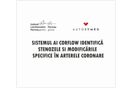 Sistemul AI Corflow identifică stenozele și modificările specifice în arterele coronare