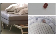 Scandal la Spitalul Județean Vâlcea: Copiii internați, nevoiți să doarmă pe saltele pline de gândaci