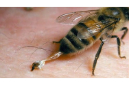Medicii ieşeni trag un semnal de alarmă: o simplă înţepătură de albină poate conduce la deces