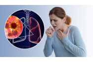 Poluarea, principala cauză a cancerului pulmonar
