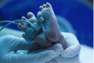 „Boala albastră” lovește în nou-născuți