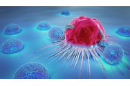 Terapia cancerului: efectele, influențate de genetică
