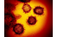 Bilanț ÎNGRIJORĂTOR - Sute de cazuri cu coronavirus confirmate în SUA! Lista deceselor și a cazurilor de COVID-19