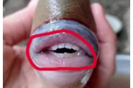Peştele cu dinţi de om